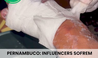 Influencers sofrem queimaduras após prova de resistência com gelo em reality